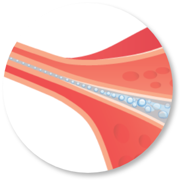 FemVue for Infertility Testing Step 3